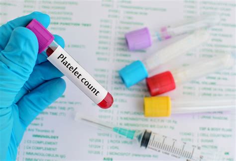 Platelet Count as a part of Hemogram or CBC. | VIP Lab