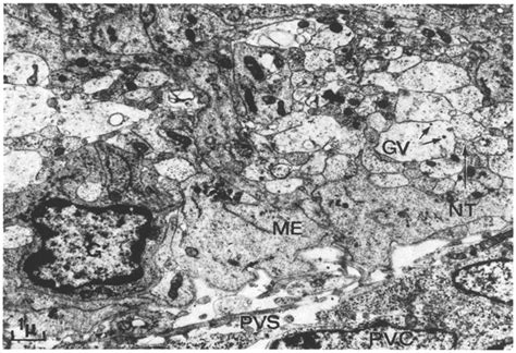 Low-power electronmicrograph of the median eminence (ME) of a rat at... | Download Scientific ...