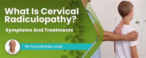 What Is Cervical Radiculopathy? Symptoms And Treatments