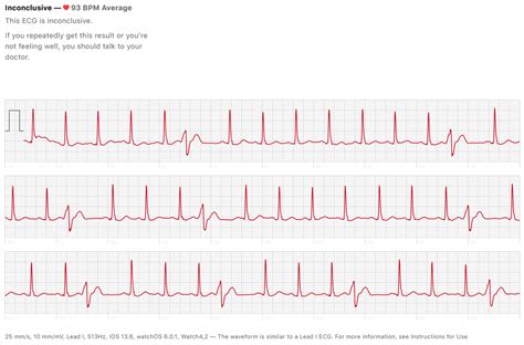 My mother has been having a fast heartbeat for the last couple of days. Today I noticed skipped ...