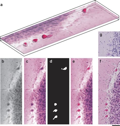 Localisation of the Purkinje cells using histological findings and its... | Download Scientific ...