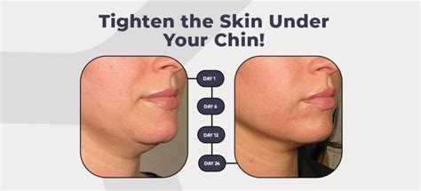 12 Non-Surgical Ways To Tighten the Skin Under Your Chin | Mewing.coach