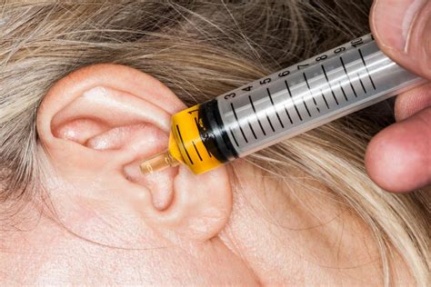 Why does my ear feel clogged? Home remedies for wax and more