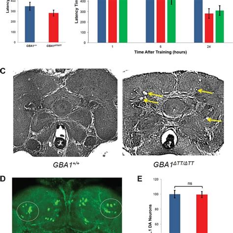 Glucocerebrosidase deficiency mildly enhances α-synuclein toxicity in... | Download Scientific ...