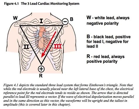 Einthoven's Triangle correlates to 3-lead cardiac monitoring leads | Nursing courses, Cardiac, Nurse