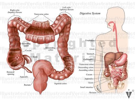 Stock Colon: Normal Anatomy — Illustrated Verdict