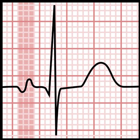 P Wave - The Definitive Guide | Biology Dictionary