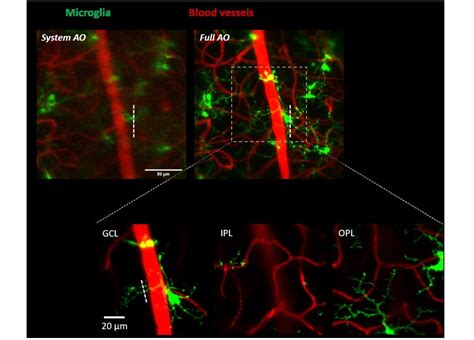 Adaptive optics microscopy for fine live imaging | Qu Lab @ HKUST