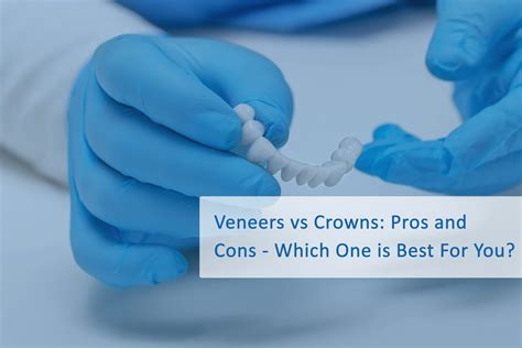 Veneers vs Crowns: Pros and Cons - Which One is Best For You? | Wellness Dental Studio