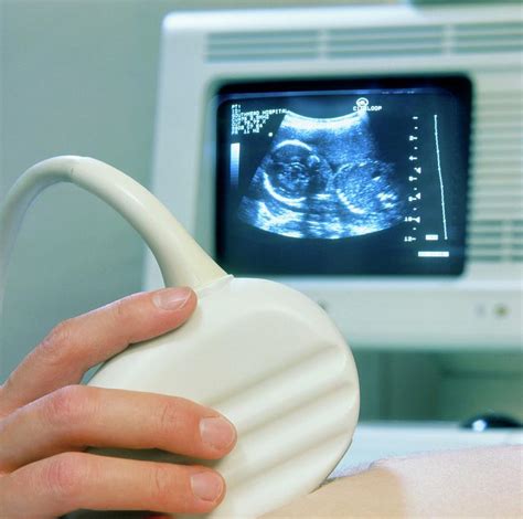 Ultrasound Scanning Of A Pregnant Woman Photograph by Saturn Stills/science Photo Library - Pixels