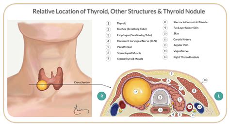 Lump In Throat Thyroid