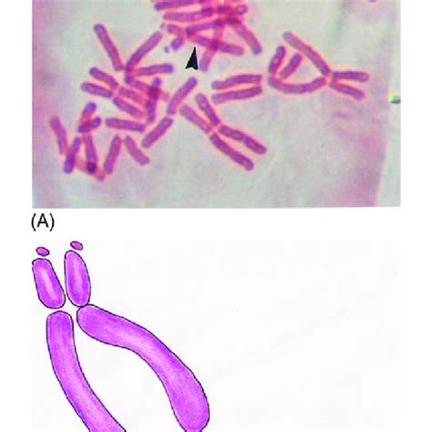 Euploidy in the chromosome set of the onion (Allium cepa L.); Basic ...