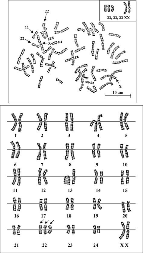 Metaphase chromosome (top) and karyotype (bottom) of female siamang... | Download Scientific Diagram