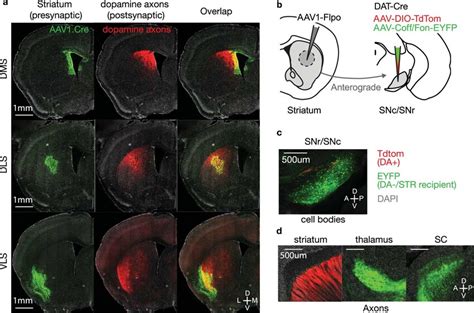 Anterogradely labelled putative dopamine axons in striatum a, Example... | Download Scientific ...