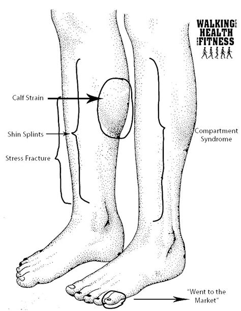 How to Treat Lower Leg Pain at Home — Walking for Health and Fitness