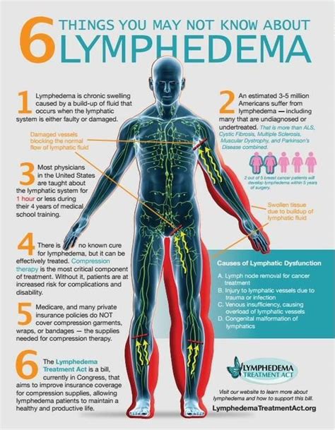 #lymphedema #lymphsystem #lymph #swelling www.longwellmassagetherapy ...