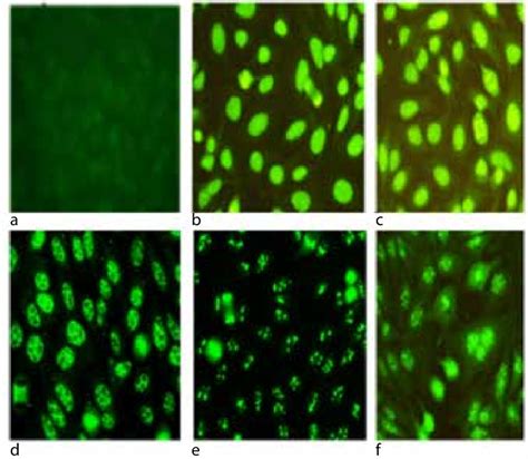 -Common ANA patterns by IIF: a, negative sample; b, homogeneous; c,... | Download Scientific Diagram