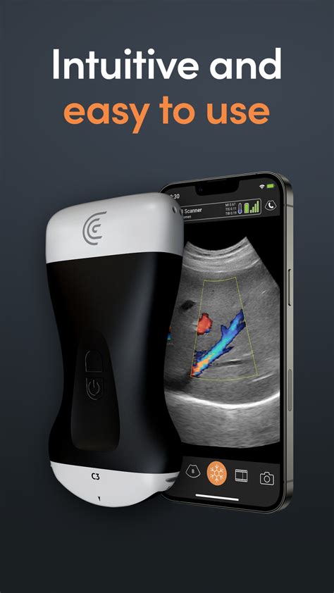 Clarius Ultrasound App for iPhone - Download