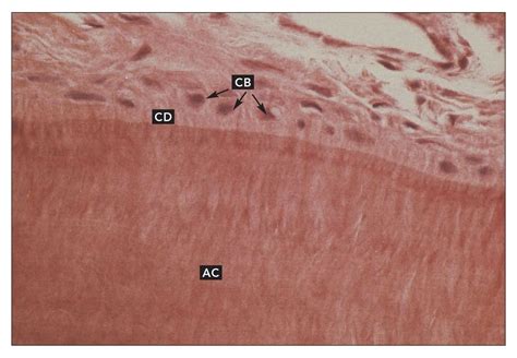 CEMENTUM | Pocket Dentistry