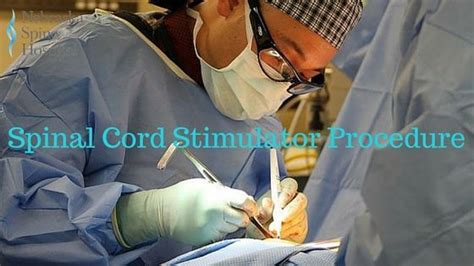 Spinal Cord Stimulator Procedure - What You Need To Know - Nebraska ...