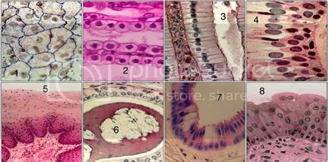 Types of Epithelial Tissue (with slides) Quiz - By juderigby