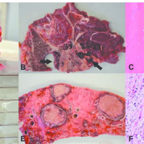 Macroscopic and histologic features of the invasive hemangiosarcoma ...