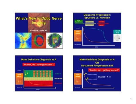 What's New in Optic Nerve Imaging - Amedeolucente.it