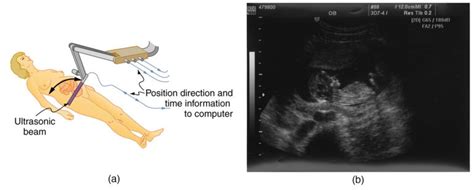 Ultrasound | Physics