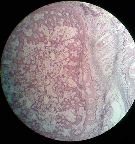 Skeletal Muscle Histology | howMed Images