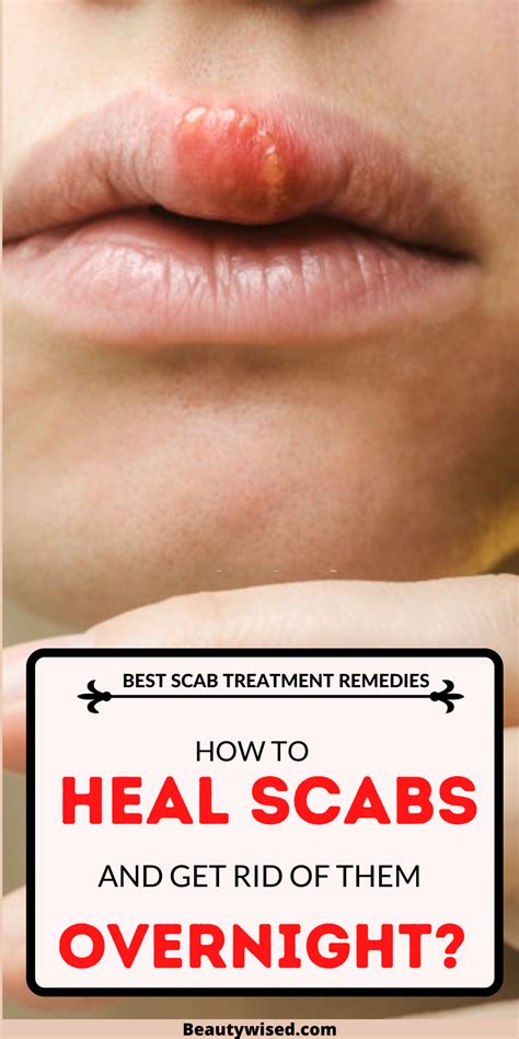 How to get rid of scabs on your scalp, on the face, or on your body fast naturally? in 2020 ...