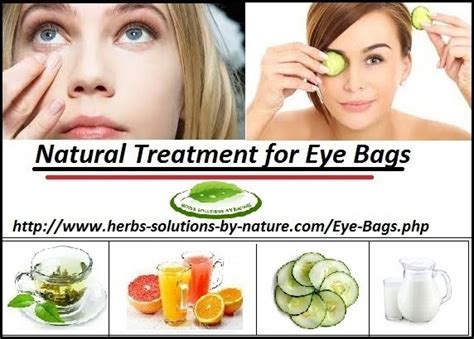 9 Natural Remedies for Eye Bags Best Cure for Puffy Eyes at Your Home - Dubai Entertainment