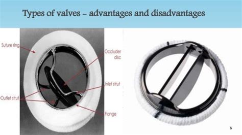 Mechanical Heart Valves