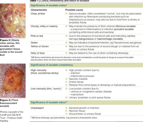 Figure 4 from Wound exudate and the role of dressings. A consensus ...