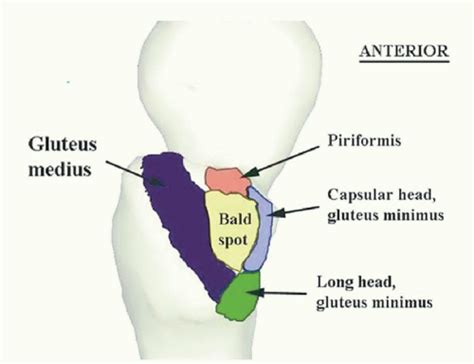 Periarticular Arthroscopy | Musculoskeletal Key