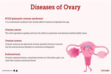 Ovary Of Women