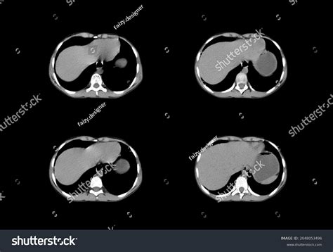 Chest Ct Scan Mri Images Stock Photo 2048053496 | Shutterstock