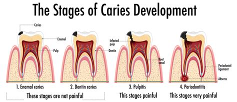 How to Get Rid of Gingivitis | Self-Care | Advanced Smile Dentistry