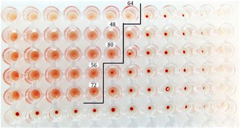 Hemagglutination assay. The results obtained from the HA assay to... | Download Scientific Diagram