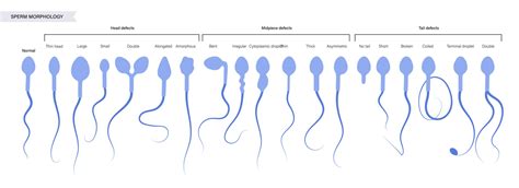 Sperm Morphology Defects - Fertility Answers