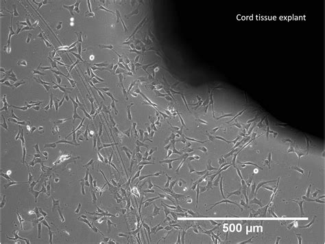 Isolation and Establishment of Mesenchymal Stem Cells from Wharton’s ...