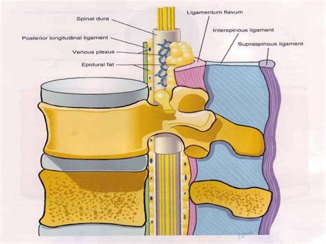 COMPLICATIONS OF SPINAL & EPIDURAL ANAESTHESIA