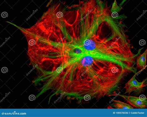 Fluorescence Microscope Image of Cells Undergoing Mitosis Stock Photo - Image of laboratory ...