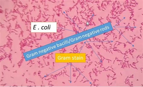 E Coli Gram Stain 100x