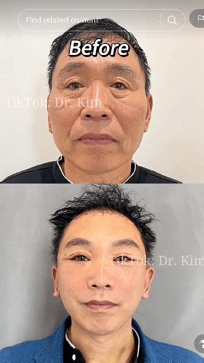 Tiktok Doctor Posts Before And After Pics With Horrifying Results(pictures) - Health - Nigeria