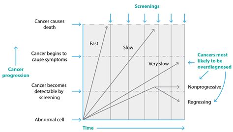 What is overdiagnosis and why should we take it seriously in cancer screening? | PHRP