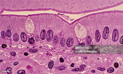 Simple Columnar Epithelium Small Intestine Supporting Connective Tissue ...