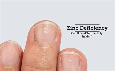 Everything about zinc deficiency; Symptoms, risks - GreenBHL