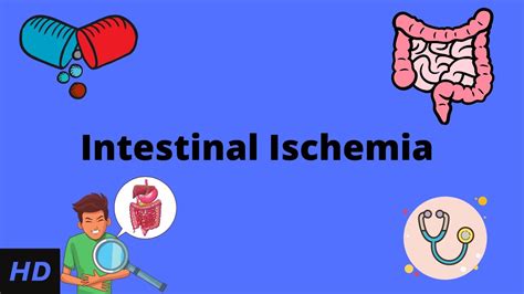 Intestinal Ischemia, Causes, Signs and Symptoms, Diagnosis and ...