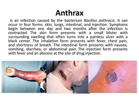 Microbiological diagnostics of anthrax, ricketsiosis and legionellosis ...