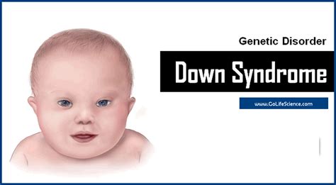 Genetic Disorders and Down Syndrome